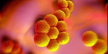 Σταφυλόκοκκος: Τι προκαλεί σε δέρμα, στομάχι, αίμα και αρθρώσεις και πώς θεραπεύεται