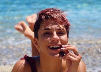 Κάτια Ταραμπάνκο: Έχω ψωρίαση και μου εμφανίζεται όταν πιέζομαι