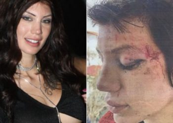 Μαρία Αλεξάνδρου: “Άρχισαν να με χτυπούν δυνατά στο κεφάλι-Έξι γυναίκες με ξεφτίλισαν”