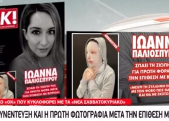 Επίθεση με βιτριόλι: Έτσι είναι πλέον το πρόσωπο της Ιωάννας-Η Πρώτη φωτογραφία[video]