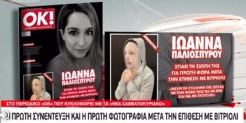 Επίθεση με βιτριόλι: Έτσι είναι πλέον το πρόσωπο της Ιωάννας-Η Πρώτη φωτογραφία[video]