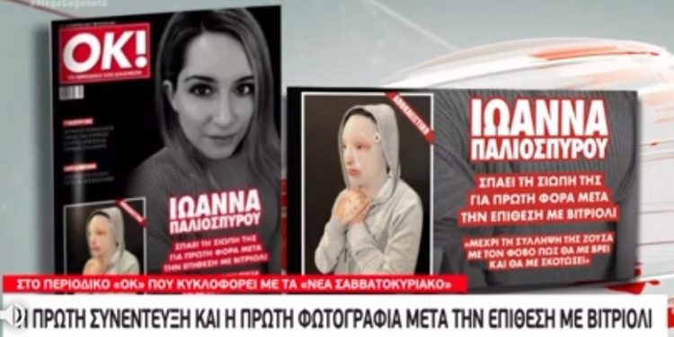 Επίθεση με βιτριόλι: Έτσι είναι πλέον το πρόσωπο της Ιωάννας-Η Πρώτη φωτογραφία[video]
