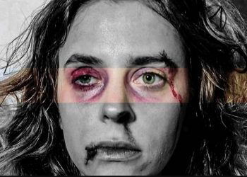 Άγριες Μέλισσες: Οι φωτογραφίες της κακοποιημένης Σοφούλας κάνουν τον γύρο του διαδικτύου