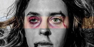 Alldaynews.gr Άγριες Μέλισσες: Οι φωτογραφίες της κακοποιημένης Σοφούλας κάνουν τον γύρο του διαδικτύου