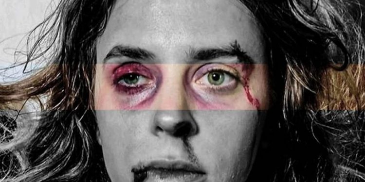 Alldaynews.gr Άγριες Μέλισσες: Οι φωτογραφίες της κακοποιημένης Σοφούλας κάνουν τον γύρο του διαδικτύου