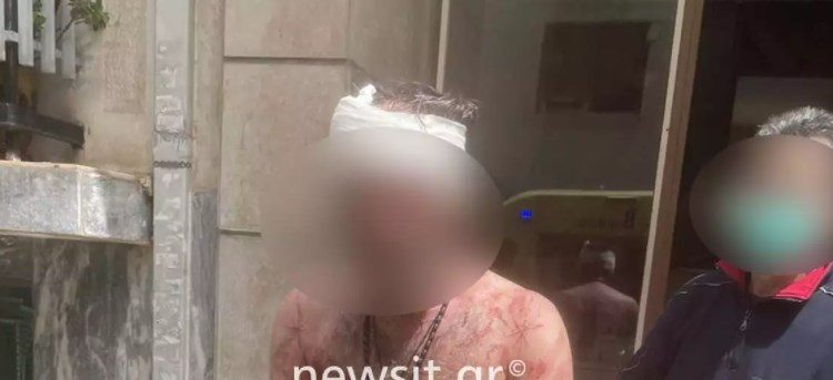 Πριν Λίγο-Πατήσια: Μαχαίρωσε τον αδερφό του, αυτοτραυματίστηκε και επιτέθηκε σε αστυνομικό