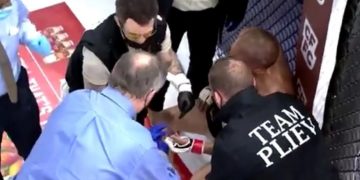 Σοκαριστικό ατύχημα: Μαχητής MMA έχασε το δάχτυλό του εν ώρα αγώνα[Βίντεο-Σκληρές Εικόνες]