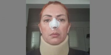 Alldaynews.gr Δέσποινα Πλατανάκη: 27χρονος της επιτέθηκε με μαχαίρι για να την βιάσει – «Με χτυπούσε με μπουνιές…»