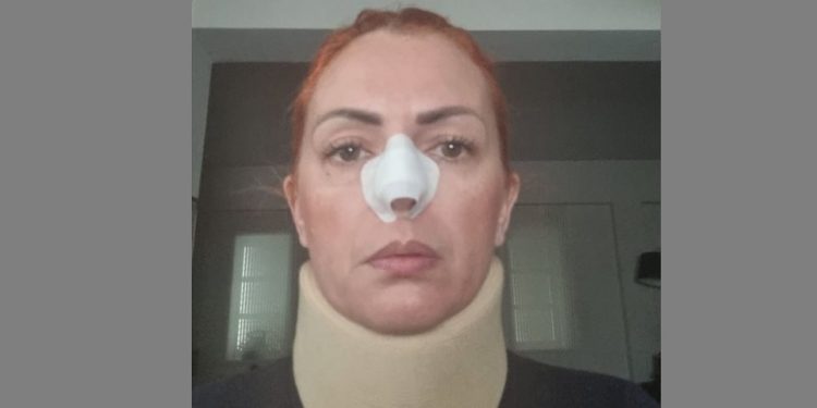 Alldaynews.gr Δέσποινα Πλατανάκη: 27χρονος της επιτέθηκε με μαχαίρι για να την βιάσει – «Με χτυπούσε με μπουνιές…»