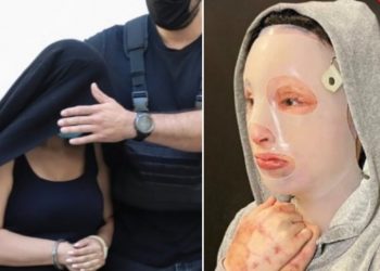 Επίθεση με βιτριόλι: «Δεν δέχομαι καμία συγγνώμη» απαντά η Ιωάννα στην 35χρονη