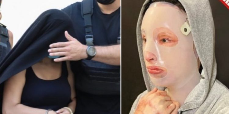 Επίθεση με βιτριόλι: «Δεν δέχομαι καμία συγγνώμη» απαντά η Ιωάννα στην 35χρονη