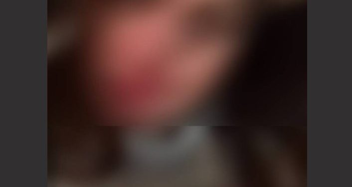 Κυψέλη: Αυτή είναι η 25χρονη έγκυος που δέχτηκε επίθεση με καυστικό υγρό[Φωτογραφίες]