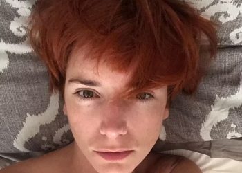 Κύπρος: Αυτό είναι το μοντέλο που πέθανε από θρομβοεμβολικό επεισόδιο μετά τον εμβολιασμό της