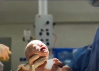 «Γέννησα διασωληνωμένη»-Συγκλονίζει η γυναίκα που νοσηλεύτηκε στο Αττικόν[video]