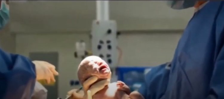 «Γέννησα διασωληνωμένη»-Συγκλονίζει η γυναίκα που νοσηλεύτηκε στο Αττικόν[video]