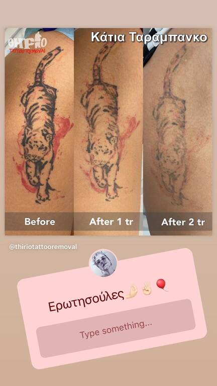 Κάτια Ταραμπάνκο: Αφαίρεσε τα τατουάζ και το σώμα της είναι κάπως έτσι (vid)