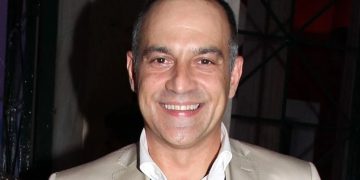 Κρατερός Κατσούλης: Έκανε εμφύτευση μαλλιών και μας δείχνει το αποτέλεσμα![photo]