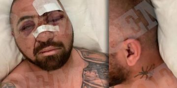 Σοκάρουν οι εικόνες του σωματοφύλακα του Μπιλζέριαν: «Eίμαι τυχερός που ζω» (vid)