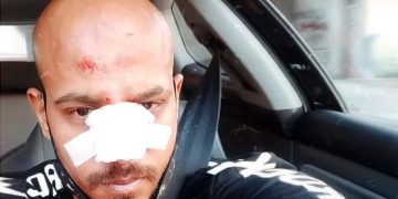 Alldaynews.gr νεαρός