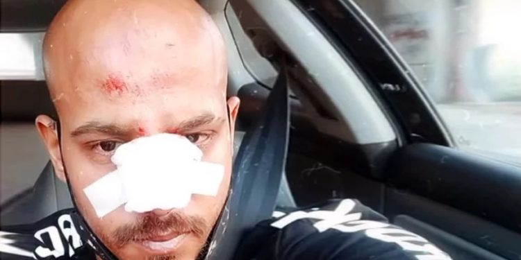 Alldaynews.gr νεαρός