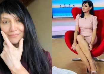 Αθηναΐς Νέγκα: Έχει λεύκη και δείχνει τα σημάδια της – «Τώρα μπορώ να μιλάω πιο άνετα για αυτή»