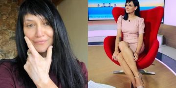 Alldaynews.gr Αθηναΐς Νέγκα: Έχει λεύκη και δείχνει τα σημάδια της – «Τώρα μπορώ να μιλάω πιο άνετα για αυτή»