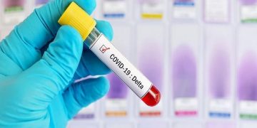 Μετάλλαξη Delta: Τα τρία σενάρια που αναλύει ο Νίκος Τζανάκης