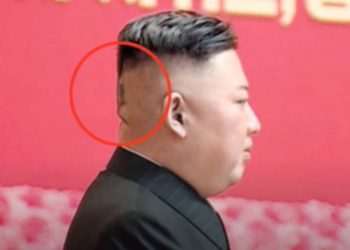 Β. Κορέα: «Μυστηριώδες» τσιρότο στο κεφάλι του Κιμ Γιονγκ Ουν πυροδοτεί νέες φήμες για την υγεία του[video]