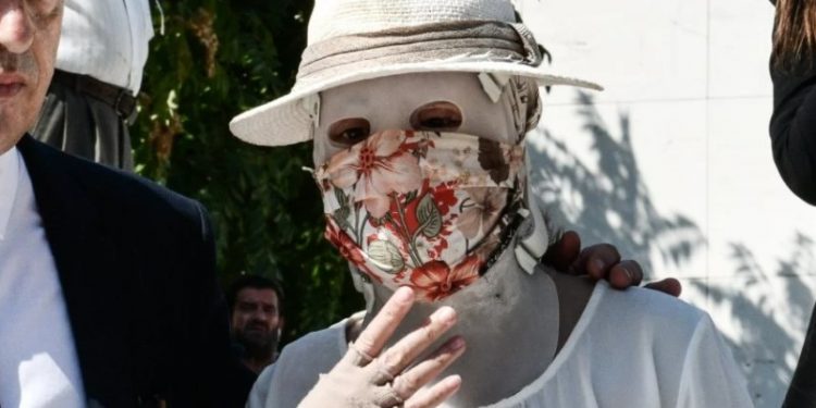 Alldaynews.gr Επίθεση με βιτριόλι: Οι πρώτες αντιδράσεις της κατηγορούμενης και του 40χρονου μετά την συνέντευξη της Ιωάννας