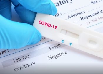 Δείτε πόσο θα κοστίζουν από Δευτέρα τα rapid test!