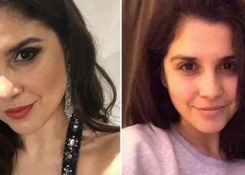 Ελληνίδα διαγωνίζεται στα βρετανικά καλλιστεία χωρίς μακιγιάζ – «Με φώναζαν ‘γορίλα’ στο σχολείο»