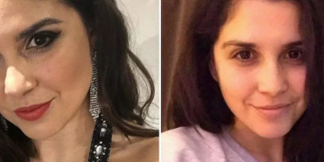 Alldaynews.gr Ελληνίδα διαγωνίζεται στα βρετανικά καλλιστεία χωρίς μακιγιάζ – «Με φώναζαν ‘γορίλα’ στο σχολείο»