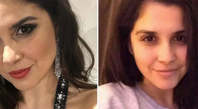 Alldaynews.gr Ελληνίδα διαγωνίζεται στα βρετανικά καλλιστεία χωρίς μακιγιάζ – «Με φώναζαν ‘γορίλα’ στο σχολείο»