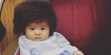 Alldaynews.gr Το μωρό με τα πολλά μαλλιά έγινε ολόκληρο κορίτσι και έχει χιλιάδες followers