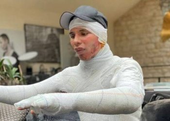 Ο σχεδιαστής του οίκου Balmain σόκαρε τον πλανήτη – Η φωτό που αποκάλυψε το φρικτό ατύχημα