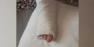 Συγκλονίζει η μητέρα του μαθητή που έπεσε θύμα bullying: Τον ανάγκασαν να πέσει από μεγάλο ύψος