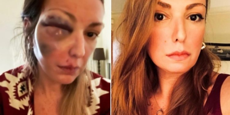 Alldaynews.gr Στεφανία Τζαφέρη: Κύμα συμπαράστασης στο Twitter για την blogger που έπεσε θύμα κακοποίησης