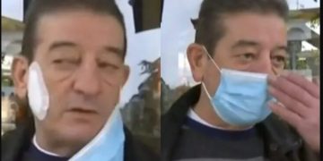 Alldaynews.gr Ηλικιωμένος Δάγκωσε τον ιδιοκτήτη καφετέριας-Δεν δεχόταν έλεγχο πιστοποιητικών