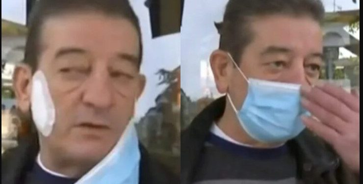 Alldaynews.gr Ηλικιωμένος Δάγκωσε τον ιδιοκτήτη καφετέριας-Δεν δεχόταν έλεγχο πιστοποιητικών