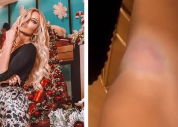 Κατερίνα Καινούργιου: Με μελανιές η παρουσιάστρια!