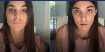 Alldaynews.gr Η φωτογραφία με την Άννα Μαρία Βέλλη κακοποιημένη από τον σύντροφό της!