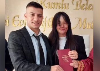 Alldaynews.gr Ξέσπασε Σάλος: 20χρονη παντρεύτηκε τον άνδρα που την παραμόρφωσε με οξύ