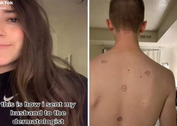 Έστειλε τον άντρα της στον δερματολόγο με κυκλωμένες τις ύποπτες ελιές και εκείνος τον έστειλε πίσω… σημειωμένο