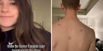 Έστειλε τον άντρα της στον δερματολόγο με κυκλωμένες τις ύποπτες ελιές και εκείνος τον έστειλε πίσω… σημειωμένο