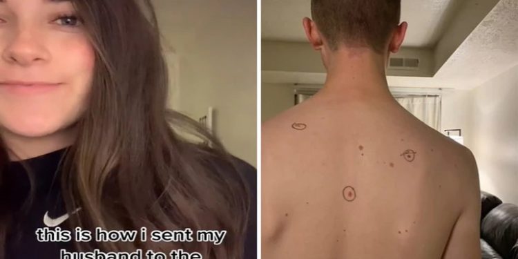 Έστειλε τον άντρα της στον δερματολόγο με κυκλωμένες τις ύποπτες ελιές και εκείνος τον έστειλε πίσω… σημειωμένο