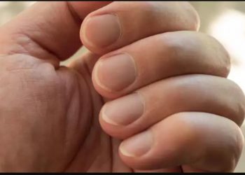 Στα νύχια φαίνονται σημαντικά προβλήματα υγείας: Τι θα προσέξετε αν σας συμβεί[photos]