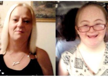 Alldaynews.gr Την άφησε να πεθάνει της πείνας: Μητέρα δολοφόνησε την Ανάπηρη κόρη της με σύνδρομο Down με τον πιο αποτρόπαιο τρόπο