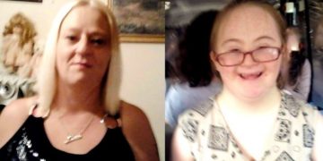 Την άφησε να πεθάνει της πείνας: Μητέρα δολοφόνησε την Ανάπηρη κόρη της με σύνδρομο Down με τον πιο αποτρόπαιο τρόπο