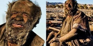 70 χρόνια χωρίς μπάνιο: O πιο βρώμικος άνθρωπος του κόσμου άφησε έκπληκτους τους γιατρούς που τον εξέτασαν[video]