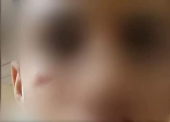 Alldaynews.gr Νέα καταγγελία: Έδειραν άγρια 14χρονο στη Θεσσαλονίκη – Ρώτησαν τι ομάδα είναι (video)